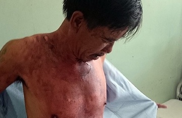 Bi danh, vo tat chao nong vao chong hinh anh