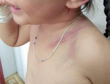 Lam ro cha duong bao hanh voi con vo 3 tuoi hinh anh