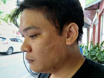 Nghi an lot nguoi, lot toi o Hai Phong hinh anh