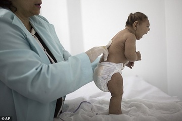 Virus Zika chinh la nguyen nhan gay benh dau nho hinh anh