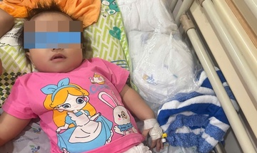 Liên tiếp trẻ ở TP.HCM nhập viện vì hóc dị vật
