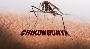 Bac si Truong Huu Khanh noi gi ve benh Chikungunya hinh anh
