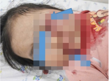 Mot giay so suat, be gai ngoi truoc xe may phai di cap cuu hinh anh