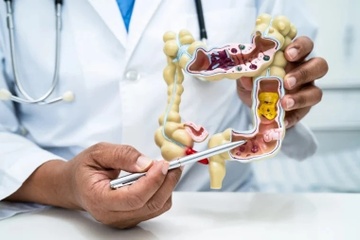 Di kham vi benh tieu hoa, bat ngo duoc chan doan mac ung thu hinh anh