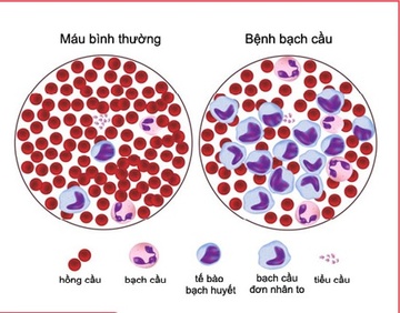 Nhung can benh nan y cac nghe si Viet mac phai hinh anh