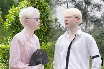 Cap song sinh bach tang hiem gap o Ha Tinh sau 12 nam noi tieng hinh anh