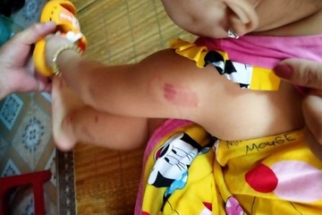 Thai Binh phu nhan thong tin tre mam non bi co giao can hinh anh