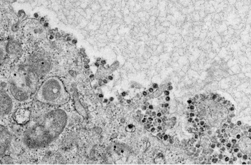 Tan Hoa Xa canh bao nguy co virus corona lay qua duong tieu hoa hinh anh