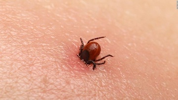 Loai virus gay tu vong len toi 40% xuat hien tai Anh hinh anh