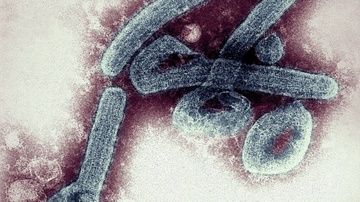 Them nguoi chet vi loai virus gay tu vong toi 90% hinh anh