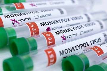 Phat hien moi ve noi ton tai cua virus dau mua khi hinh anh