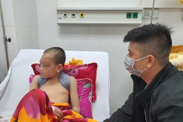 Be trai bi vo xuong so sau khi dap dau xuong duong hinh anh