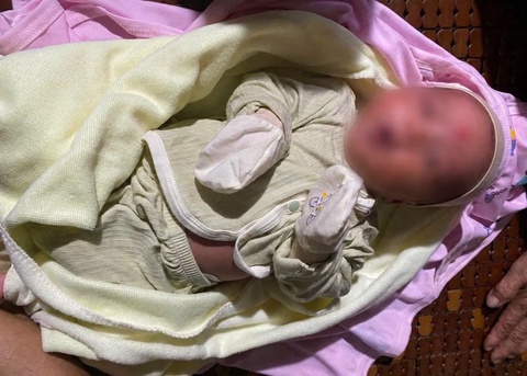 Bé trai sơ sinh bị bỏ rơi bên cống nước