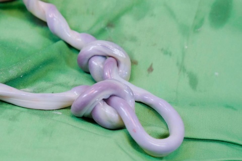 Be trai chao doi voi day ron that nut thanh bui hinh anh