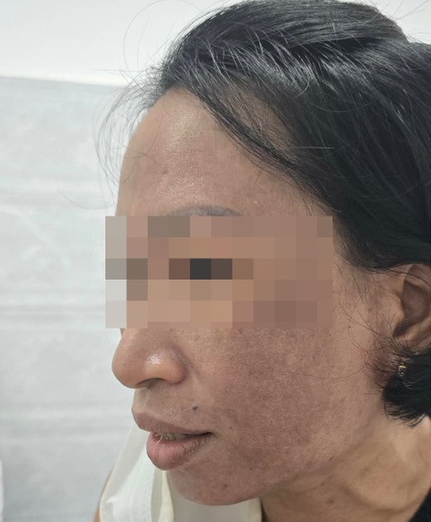 Mailisa ảnh 3 Mailisa anh 3