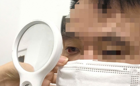 Ngua vung sinh duc du doi suot 1 nam, ket qua soi da khien bac si soc hinh anh