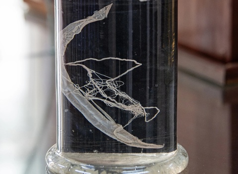 'Sat thu' an nap trong co the, am tham pha hoai gan, nao hinh anh