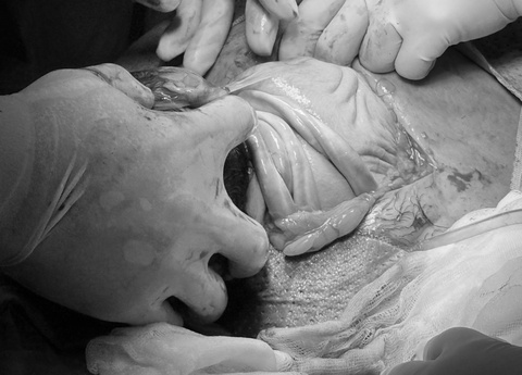 Em be chao doi voi day ron quan co 4 vong hinh anh