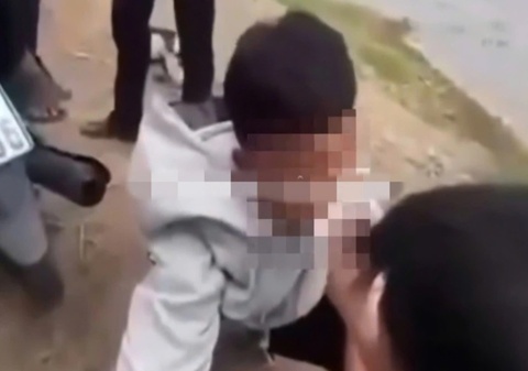 Nam sinh lop 10 o An Giang bi nhom ban nhet bang ve sinh vao mieng hinh anh