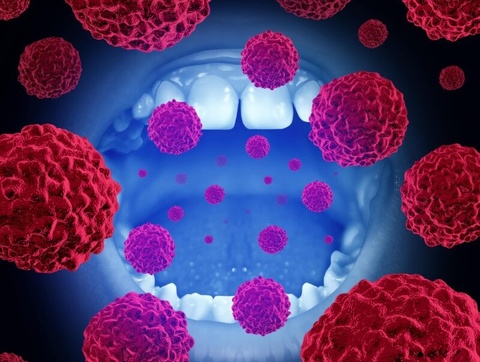 Trieu chung am tham canh bao ung thu mieng hinh anh