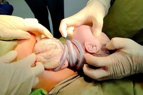 Em be chao doi voi 6 vong day ron quan quanh co hinh anh