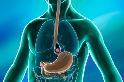 Chi trong buoi sang, benh vien phat hien 11 nguoi mac ung thu hinh anh