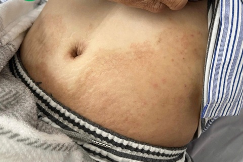 Mon khoai khau khien co gai nhiem 4 loai ky sinh trung hinh anh