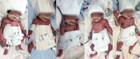 San phu 24 tuoi sinh 5, ty le 1/60 trieu ca hinh anh