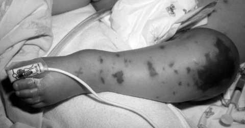 Xot xa be gai Phu Quoc khong qua khoi vi can benh dien tien qua nhanh hinh anh