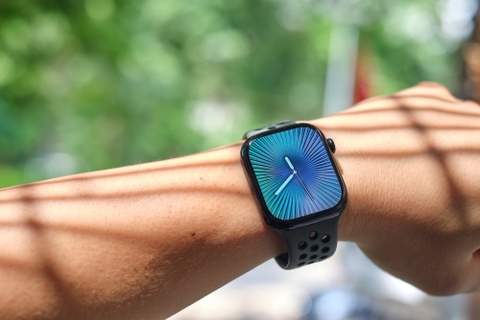 Mau Apple Watch co thay doi lon nhat nam nay hinh anh