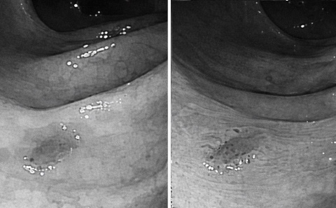 Be trai 12 tuoi mac ung thu dai truc trang giai doan cuoi hinh anh