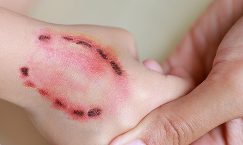 Giau chuyen bi cho can, be gai ra di thuong tam sau 48 gio phat dai hinh anh
