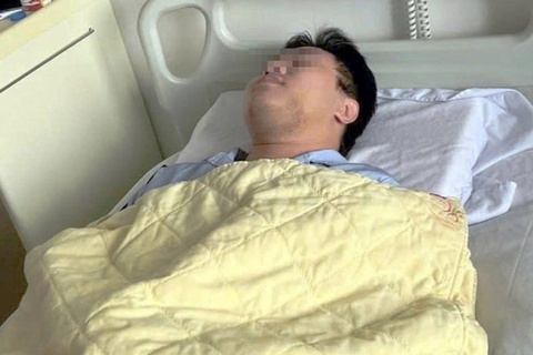 Chi vi 'anh mat', nam sinh Ha Noi bi danh gay xuong ham giua ban ngay hinh anh