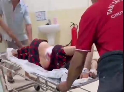 Dang tap the duc, nguoi phu nu 68 tuoi bat ngo bi dam nhieu nhat hinh anh