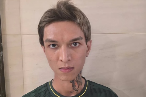 Can tay chay nghe si nhu Binh 'Gold' hinh anh