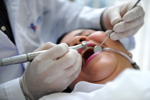 Hoi han sau khi lam rang su hinh anh