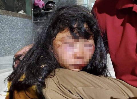 nu sinh lop 6 bi danh khi di hoc ve anh 1