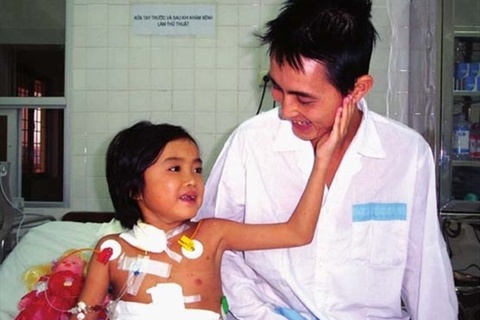 ca ghep gan dau tien tai Viet Nam anh 2