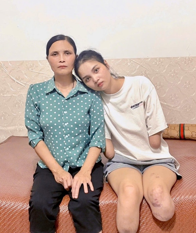 cô gái mất tứ chi ảnh 1 co gai mat tu chi anh 1