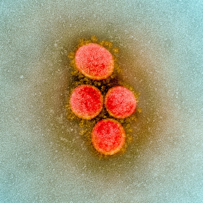 vaccine Covid-19 hieu qua khong anh 2