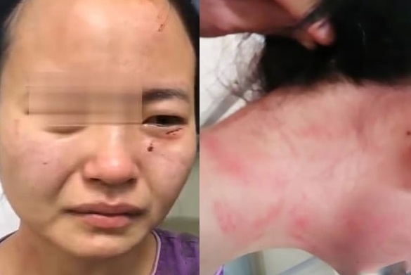 nu y ta bi danh dap anh 1