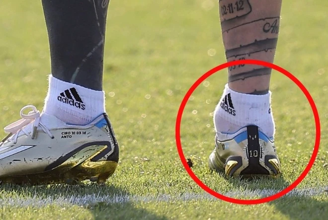 Mắt cá chân bất thường của Messi - World Cup 2022