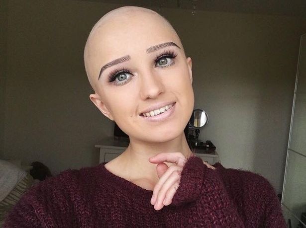 9X xinh đẹp khoe ảnh đầu trọc truyền cảm hứng cho người trẻ ...