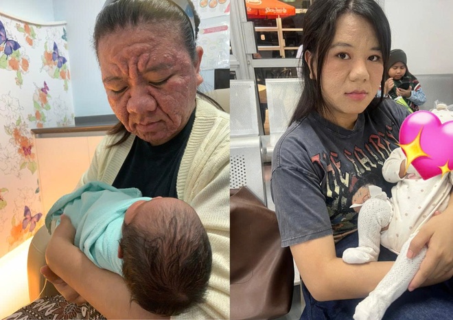 khuon mat khi mang bau anh 1