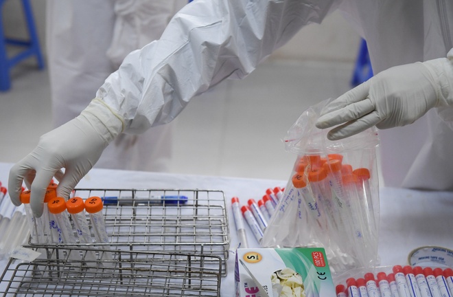 cong bo 20 ca mac Covid-19 anh 14