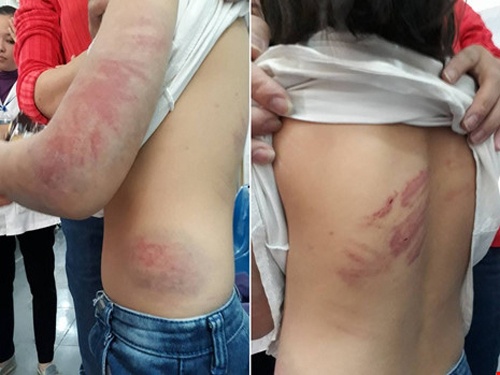 Bao hanh con gai anh 1