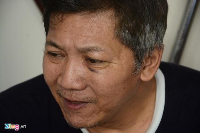 Vo su Nam Anh Kiet danh Nam Nguyen Khanh anh 1