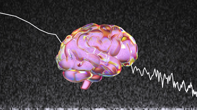 liệu pháp âm thanh điều trị Alzheimer