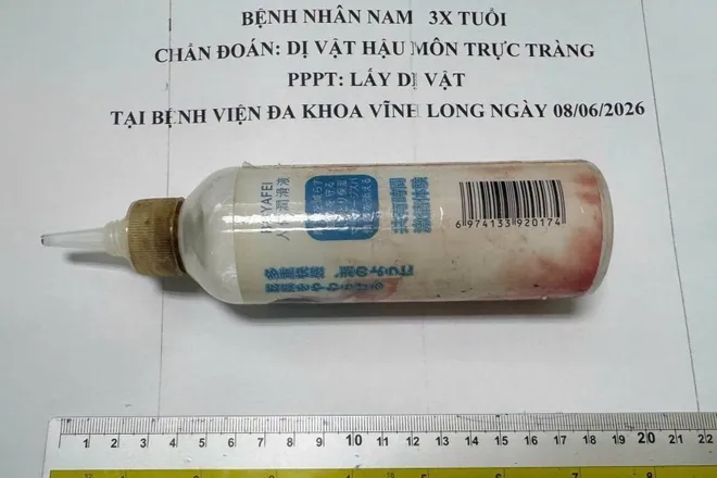 Nhập viện vì chai nhựa 20cm mắc kẹt trong trực tràng