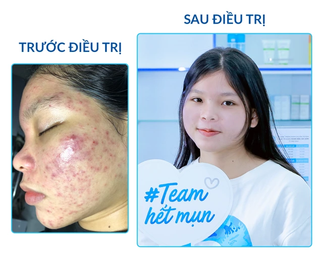 O2 Skin Cần Thơ: Dịch Vụ Chăm Sóc Da Chuyên Nghiệp và Hiệu Quả